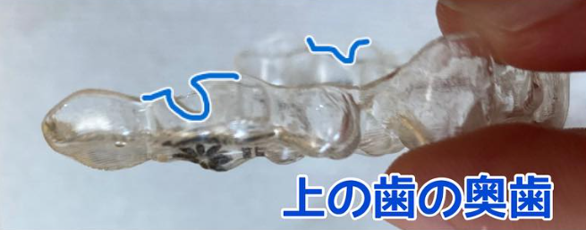 上のマウスピース