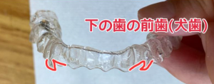 下のマウスピース