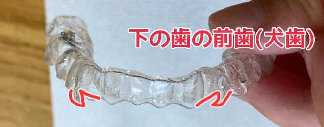 下のマウスピース